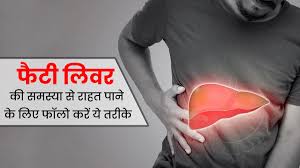 फैटी लिवर