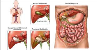gall-bladder